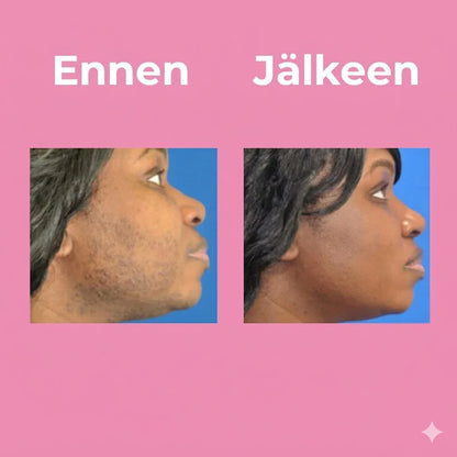 Ammattitason unisex-ihokarvanpoistovoide