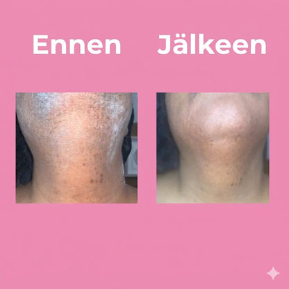 Ammattitason unisex-ihokarvanpoistovoide