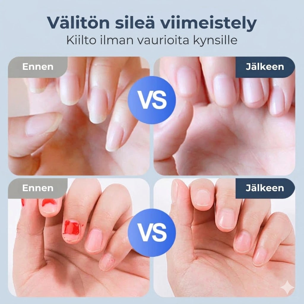 Automaattinen kynsiviila